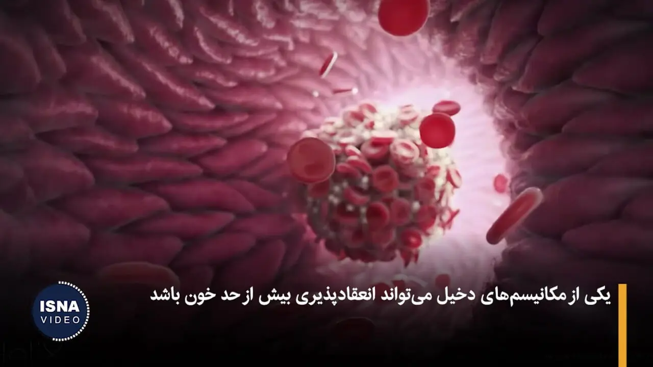 ببینید؛ هرگز با چراغ روشن نخوابید!